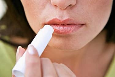Can Chapped Lips Cause Cold Sores? - Cold Sores Cured