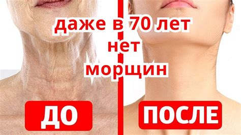 Даже в 70 лет Нет Морщин На Шее Декольте ! Маска От Морщин и Дряблости ...