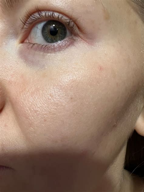 Эффективный для сухой кожи пилинг Clarins Beauty Flash Peel | Отзывы ...