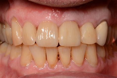 spirit dental insurance 9