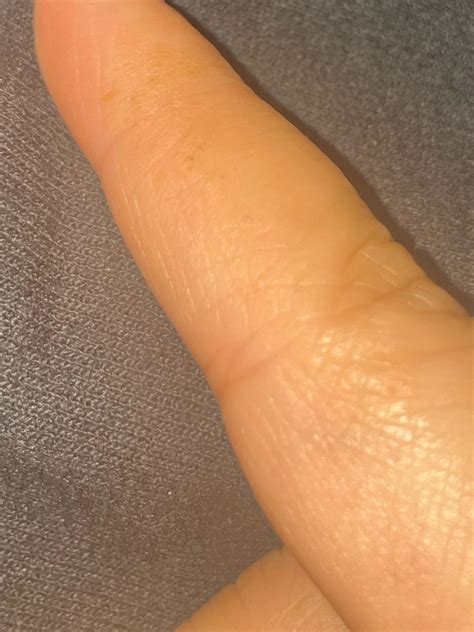 Diabetic skin lotion? : r/diabetes