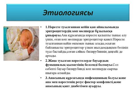 Нәрестелердегі сарғаю синдромы - презентация онлайн