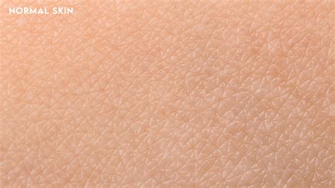 What’s your skin type? - Brilliant Skin Essentials Inc.