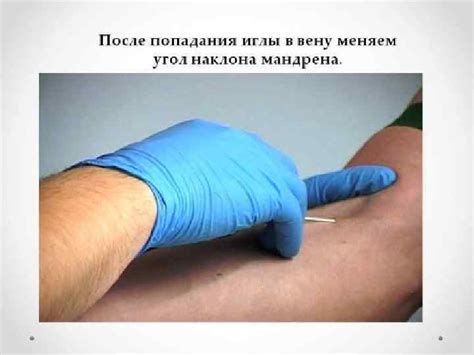 Венозный периферический катетер с дополнительным портом и крыльями