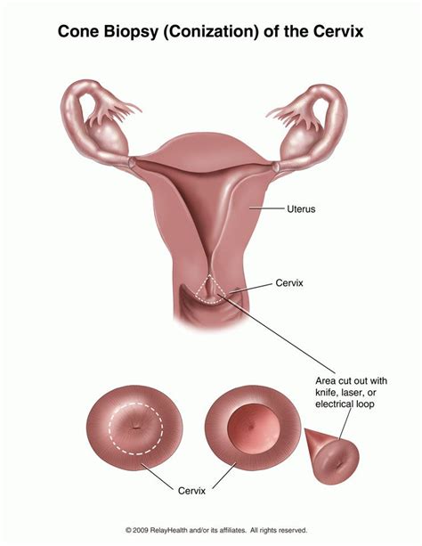 Endometrium thickness in pregnancy symptoms and treatment – Artofit