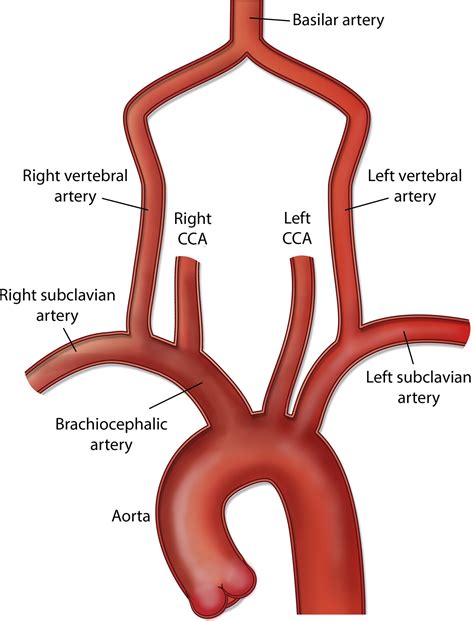 Origin Of Carotid Artery at Rose Briggs blog