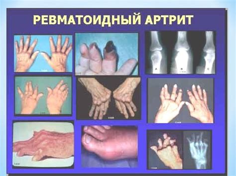 Обследование больных с заболеваниями костно-мышечной системы ...