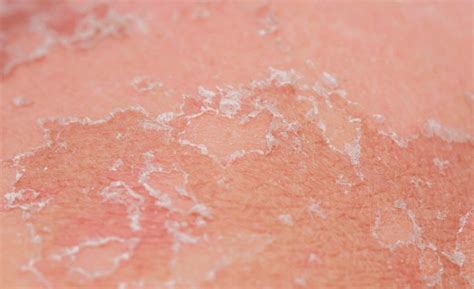 Dead Skin Off Royalty-Free Images, Stock Photos & Pictures | Shutterstock