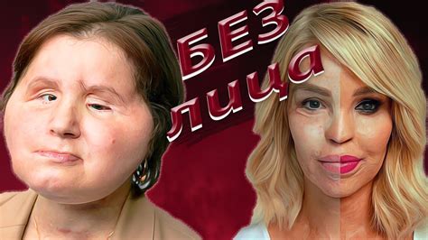 Обожжённая любовью / Она выстрелила себе в лицо. История Кэти Пайпер и ...