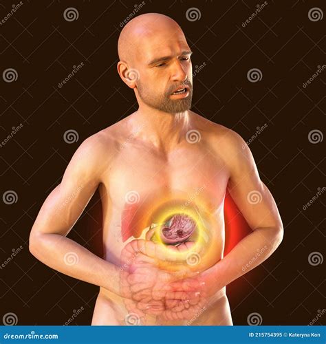 A Patient Suffering from Stomach Pain with Highlighted Inner Organs and
