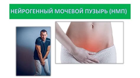 Физиология мочеиспускания - online presentation