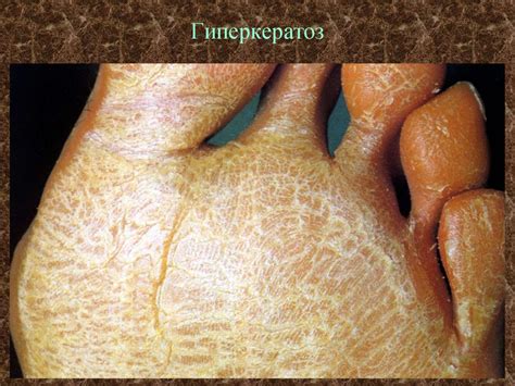 Морфологические элементы кожных сыпей - презентация онлайн