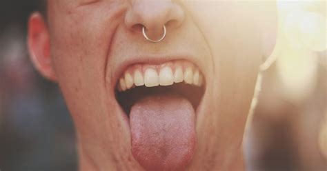 Tongue Cracks: Symptoms and Causes