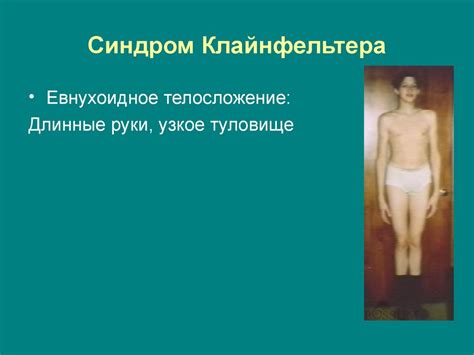 Хромосомные болезни - презентация онлайн