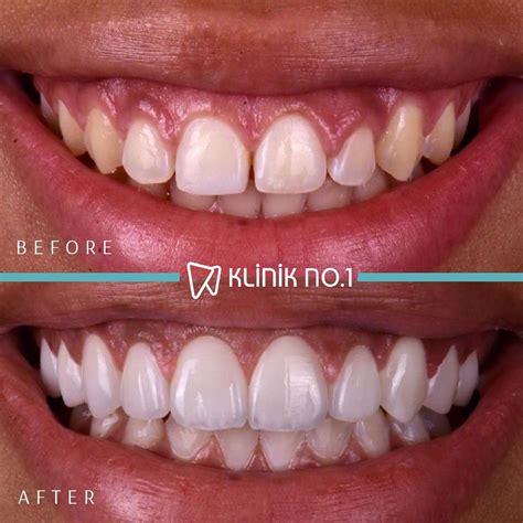 Klinik No 1 Diş Polikliniği