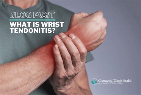 What is wrist tendonitis? - UWS Connected Whole Health - UWS Connected Whole Health