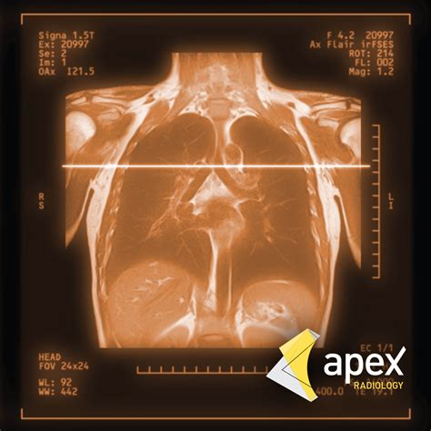 Apex Radiology, Appointment Bookings