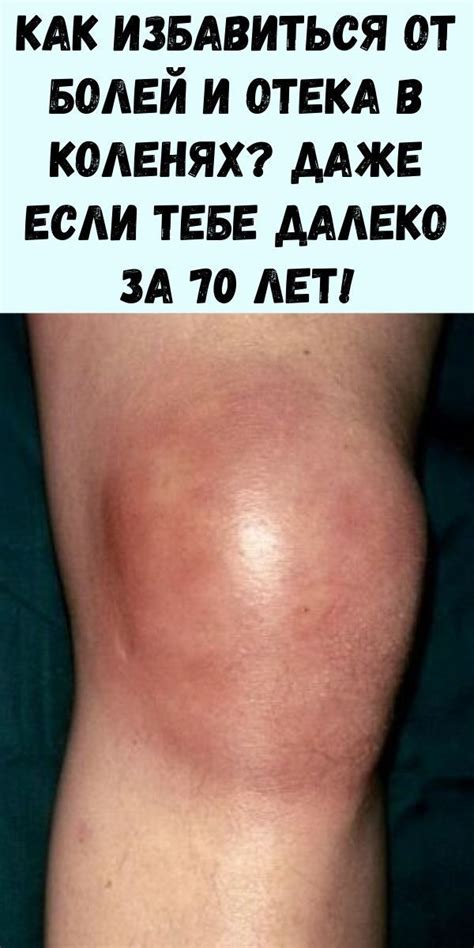 Женское здоровье | Боль в колене, Лечение ног, Средства для ...
