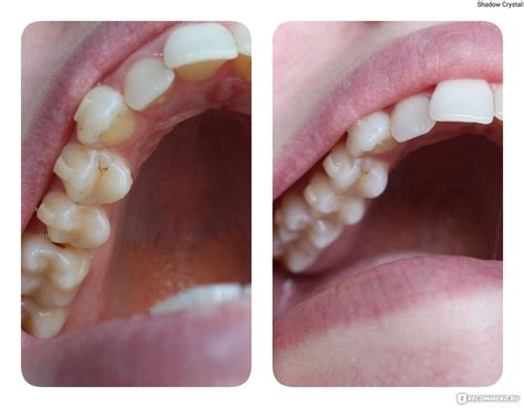 Крем для зубов GC Tooth Mousse, Tutti-Frutti - «Я не ожидала таких ...