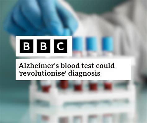 Burntwood Dementia Friendly Community