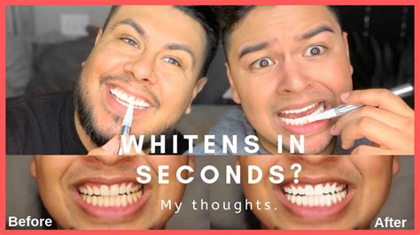 Teeth Whitening Pen Makeupalley - Mugeek Vidalondon