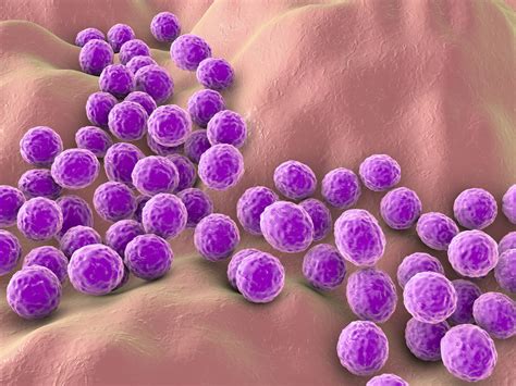 Meet the Pathogen: Staphylococcus aureus (Staph) | UL Solutions