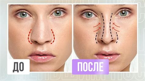 УМЕНЬШАЕМ НОС без ОПЕРАЦИЙ | Как изменить форму носа без ринопластики в ...