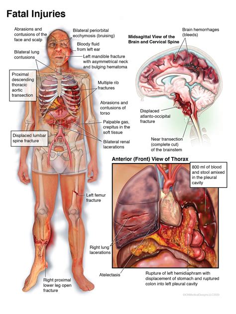 Showcase of Accurate and Visual Medical Illustrations | Ion Medical Designs