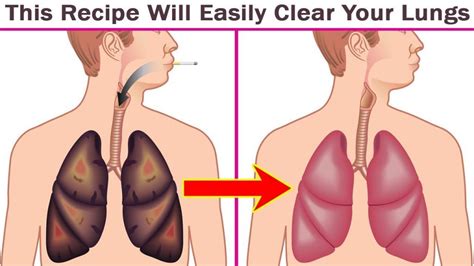 Lung-Detox Recipe - Health | Katalay.net