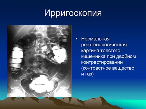 Расспрос, осмотр и иструментальные и лабораторные методы исследования ...