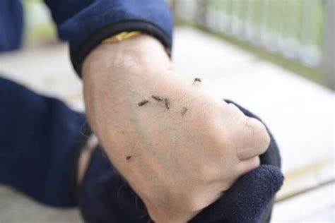 Morgellons Syndrome – Causes, Symptoms, And Treatment