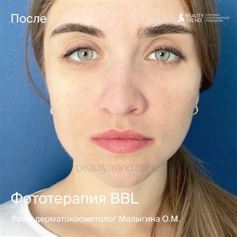 BBL - процедура фототерапии по цене от 12000 руб. в Москве в клинике ...