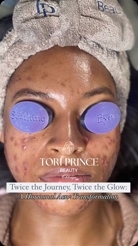 Aubrey Keys: From Scandal To Triumph – Her Inspiring Comeback Image 9