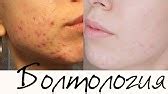 Красивый загар круглый год. Как использовать автозагары. St. Moriz ...