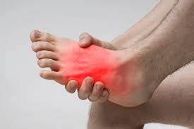 Causes of Synovitis in the Foot and Ankle - Hurst Podiatry