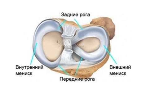 Степени повреждения мениска: классификация по Stoller