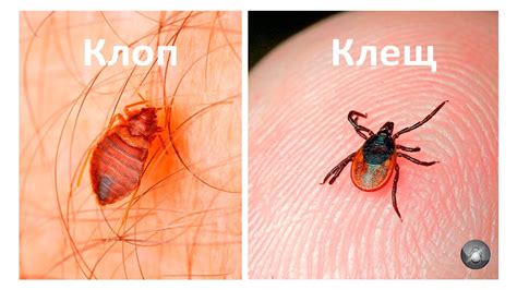 Как выглядит укус клеща фото и симптомы