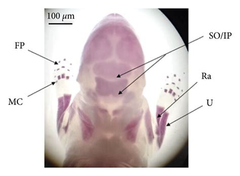 Ossification centers of 20 days old rat fetuses stained with alizarin ... 