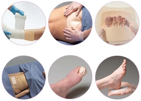 foam dressings  treating pressure ulcers  foam dressing