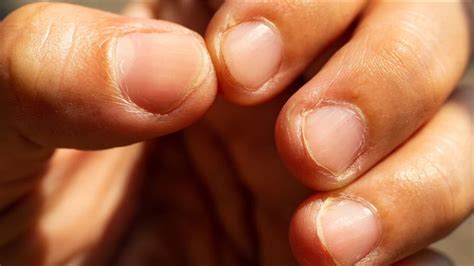 Fingernails: గోళ్లల్లో 32 రకాల బాక్టీరియాలు ఉంటాయట..మరి ఈ జాగ్రత్తలు ...