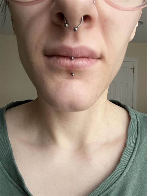 Could a day 4 vertical labret still look slanted from swelling? : r ...