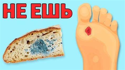 НИ В КОЕМ СЛУЧАЕ НЕ ЕШЬТЕ ПЛЕСНЕВЕЛЫЙ ХЛЕБ !!! ВОТ ПОЧЕМУ... - YouTube