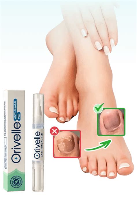 Orivelle Antifungal Pen in Canada - Official Website | Orville™