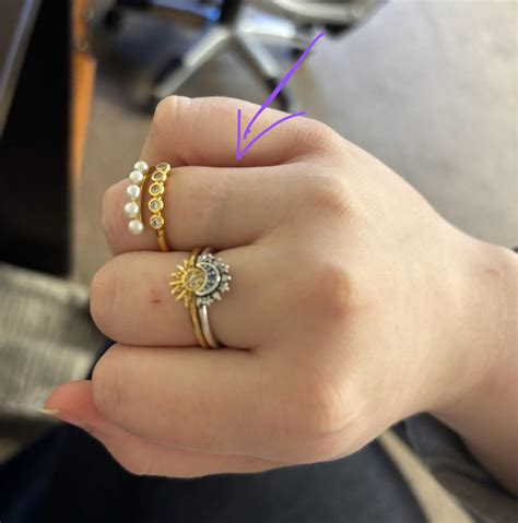 Why did my Pandora ring turn my hand black/green? | Scrolller