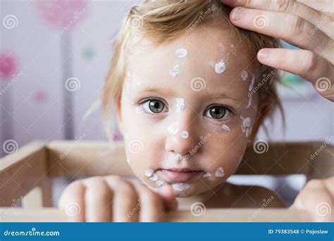 Antiseptic Face Cream