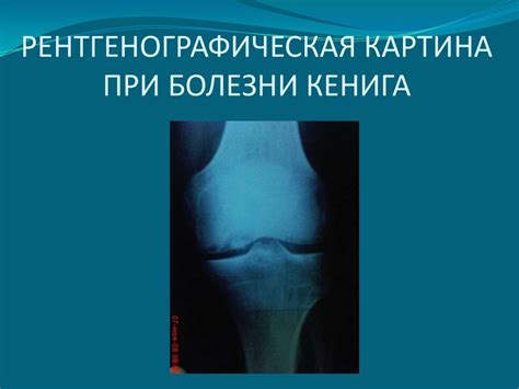Дегенеративные и воспалительные заболевания суставов - презентация онлайн