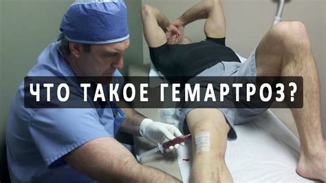 Что такое гемартроз и как он лечится? - YouTube