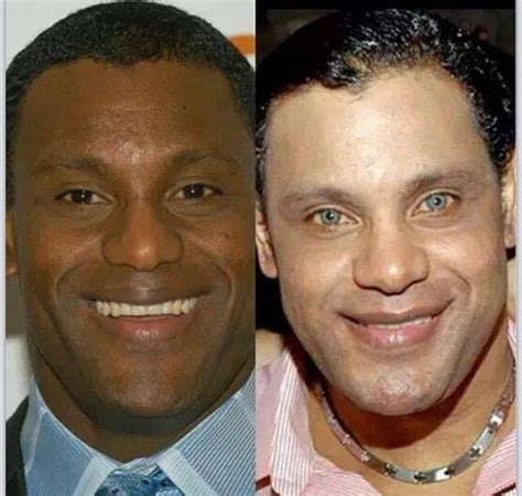 Sammy Sosa Bleached Skin