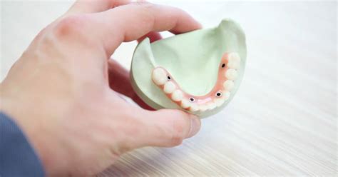 What Is An Alveolectomy? (Part Two) - Alaska Center For Oral + Facial ...