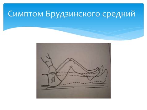 Менингит. Классификация - презентация онлайн